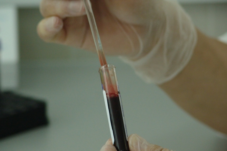 Magyar cég szállíthat vérvizsgálathoz szükséges készülékeket a világ számos részére